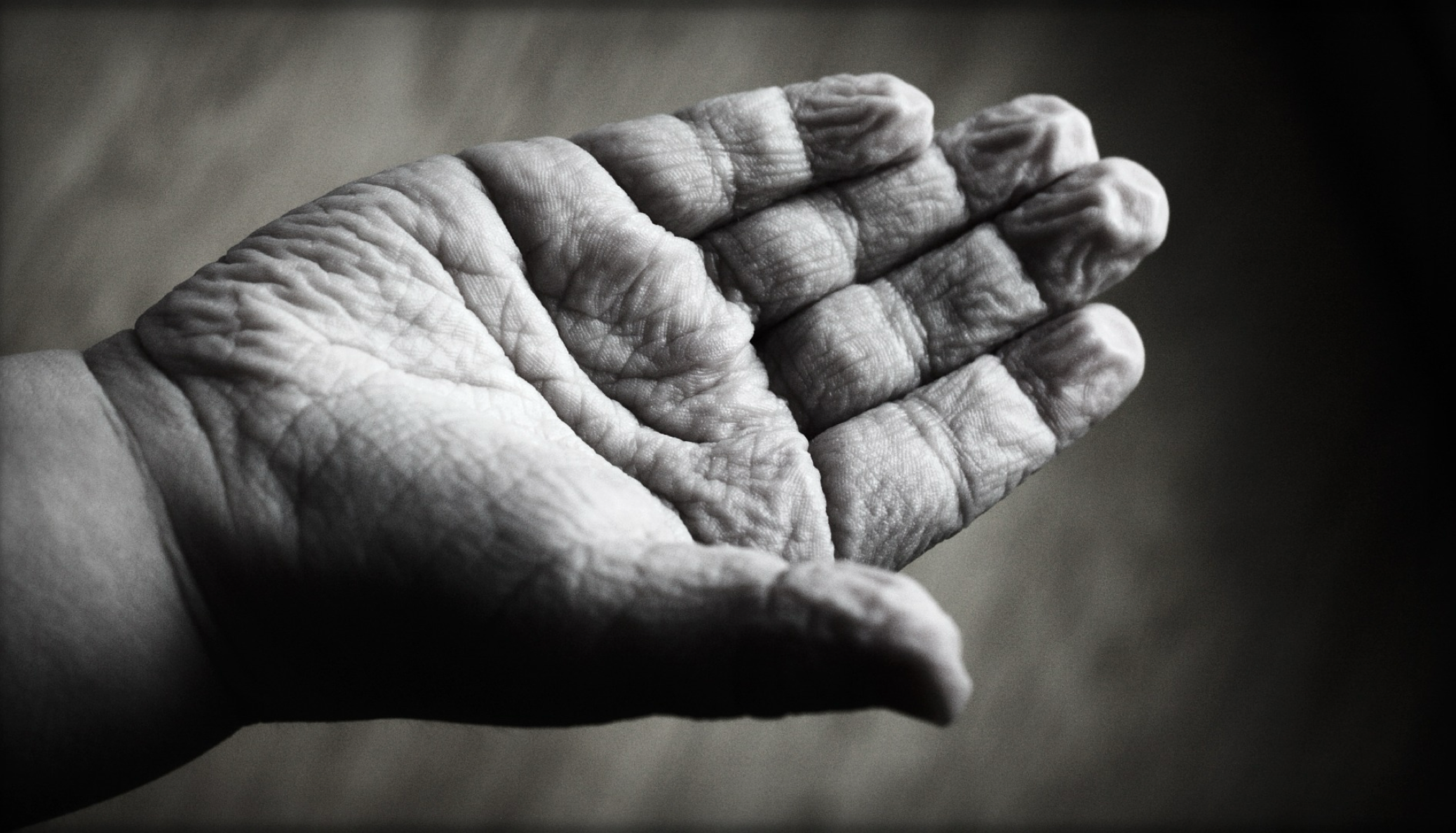 Blogbeitrag: Anti-Falten-Mitel - Bild 2